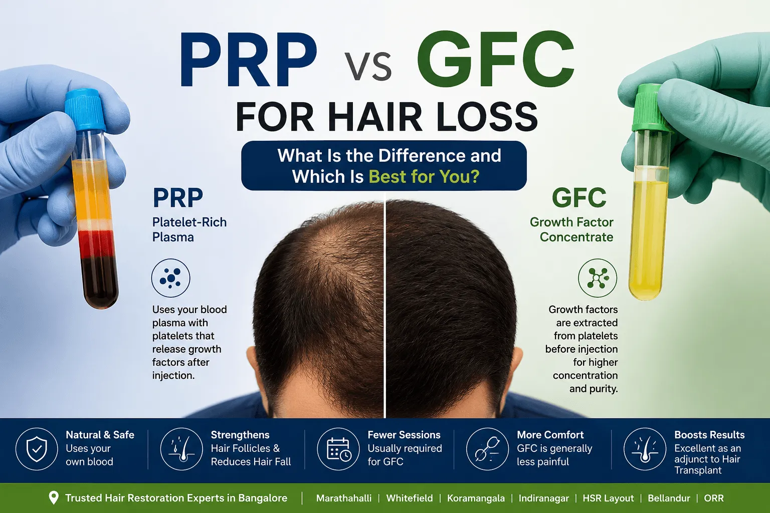 PRP Vs GFC Treatment Which is the one for you