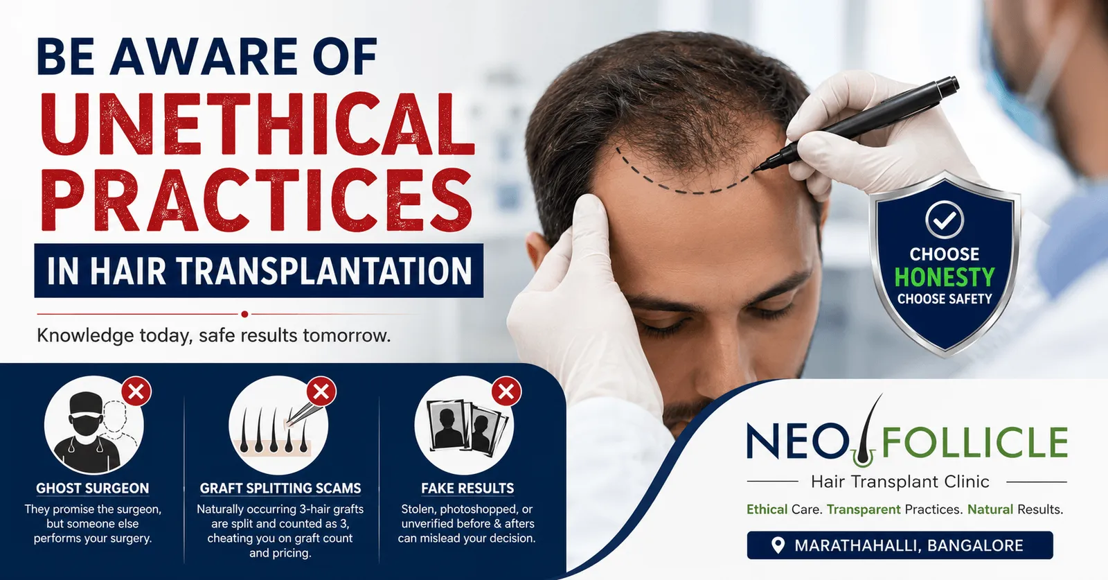 Unethical Practices in Hair Transplant