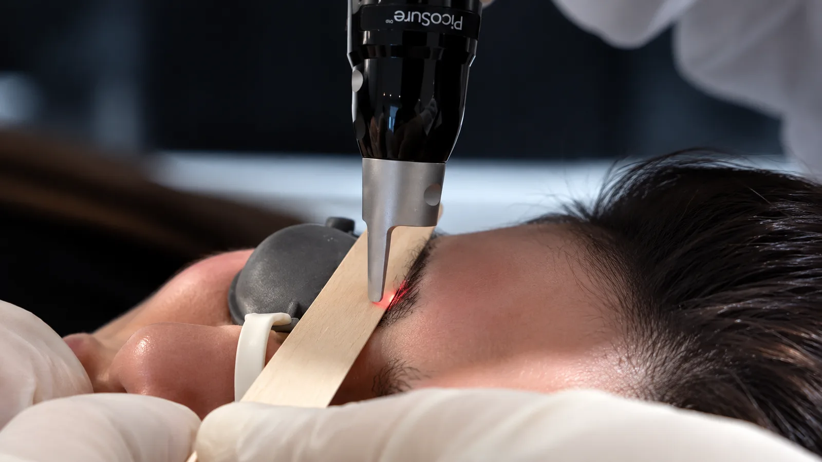 A precision device being used for an eyebrow treatment while the patient wears eye protection.