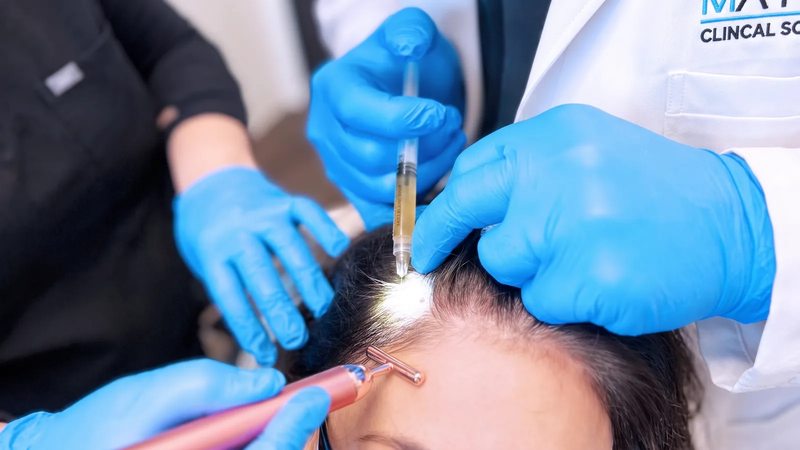 A clinician administering a regenerative GFC or PRP treatment into a patient’s scalp.