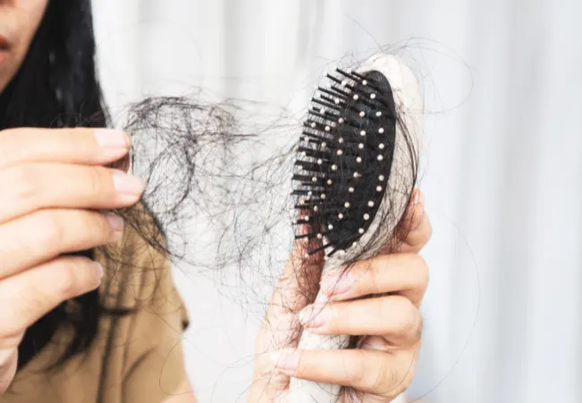 Excessive hair shedding collected after washing.