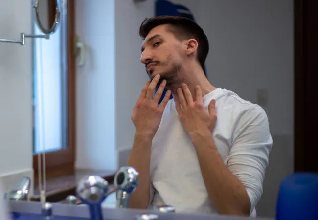 Uneven beard growth with gaps in density.