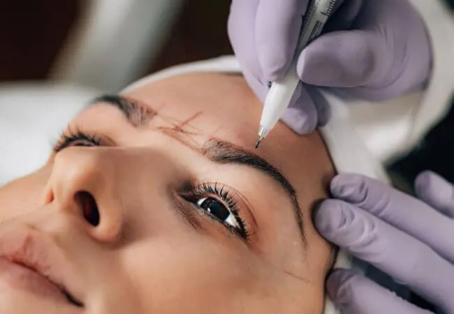 Eyebrow restoration planning for thin, over-plucked brows.