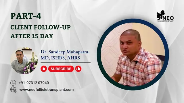 Direct Hair Transplant I Direct Hair Implantation | Best Hair Transplant in Bangalore India