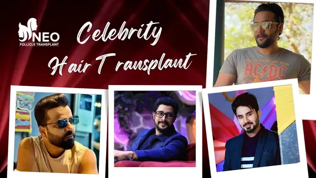 Celebrity Hair Transplant Results | Celebrity Hair Transplant #celebrityhairtransplant | NFT