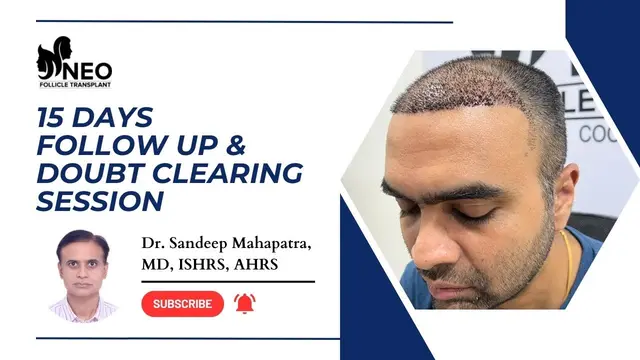 Hair Transplant After Care | Best Hair Transplant Results & Cost Of Hair Transplant In Bangalore