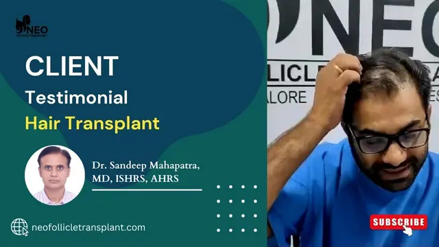 Best Hair Transplant Result | Best Hair Transplant Surgeon and cost in Bangalore | Hair Transplant
