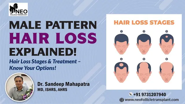 Understanding Male Pattern Hair Loss with Dr. Sandeep Mahapatra from Neo Follicle Hair transplant.