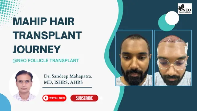 Mahip Hair Transformation | Hair Transplant in Bangalore | Hair Transplant | Hair Transplant Results