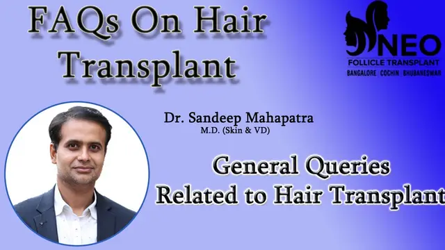 FAQs ON HAIR TRANSPLANT | Important FAQs Related to Hair Transplant