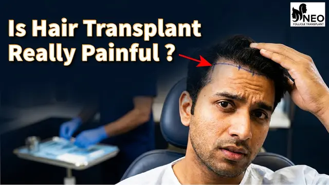 Is Hair Transplant Really Painful?