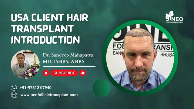 Hair Transplant for US Client | Best Hair Transplant in India | #hairtransplant #hairtransformation
