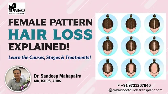 Understanding Female Pattern Hair Loss with Dr. Sandeep Mahapatra from Neo Follicle Hair Transplant.