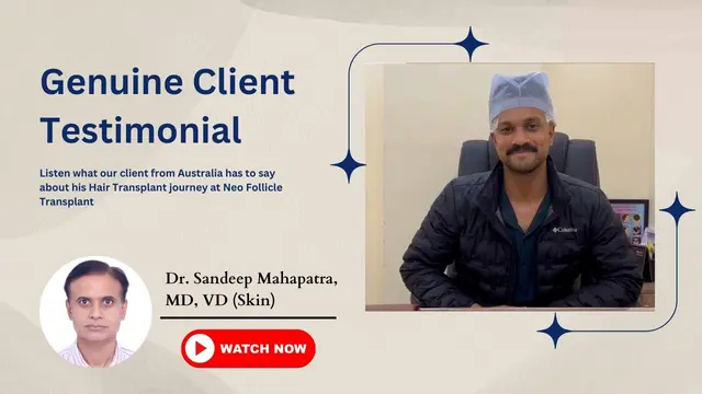 Best Hair Transplant in Bangalore | Hair Transplant Result | #beforeandafter #hairtransplantresults