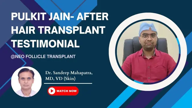 Best Hair Transplant Results & Cost Of Hair Transplant In Bangalore | Client Testimonial