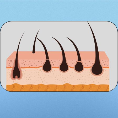 Understanding the Impact of Graft Count on Hair Transplant Costs