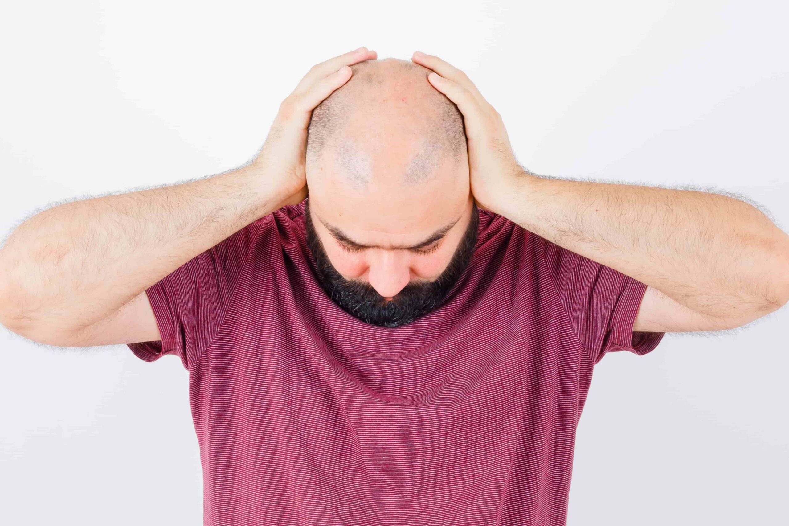 What to Do If Your Hair Transplant Fails?